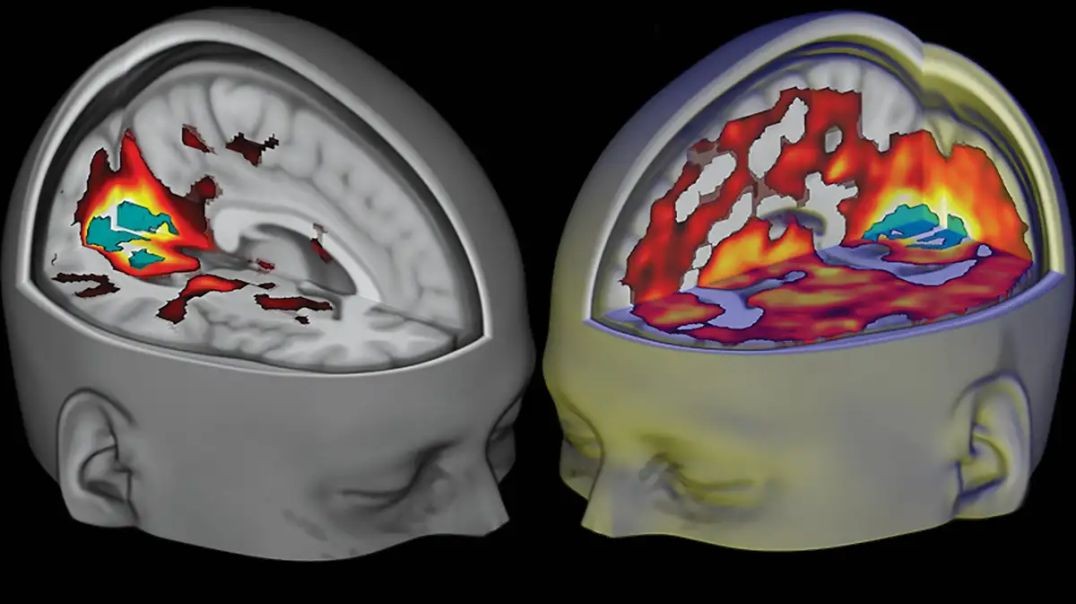 How do psychedelic drugs work on the brain_