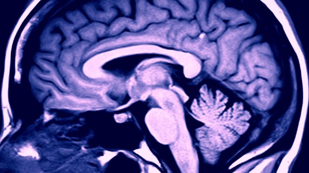 ⁣Ketamine & Depression_ How it Works - Yale Medicine Explains