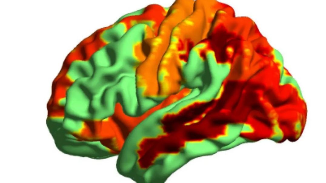 ⁣LSD study shows evidence of higher level of consciousness
